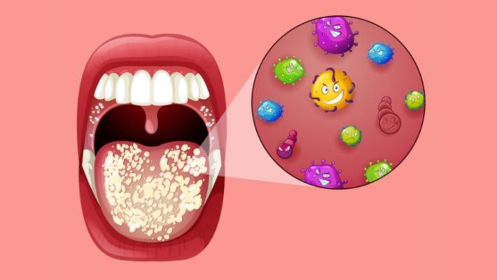 Probiotics may improve the oral microbiome 